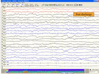 Post discharge
 