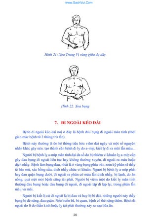 20
Hình 21: Xoa Trung Vị vùng gỉữa dạ dày
Hình 22. Xoa bụng
7. ĐI NGOÀI KÉO DÀI
Bệnh đi ngoài kéo dài nói ở đây là bệnh đau bụng đi ngoài mãn tính (thời
gian mắc bệnh từ 2 tháng trở lên).
Bệnh này thƣờng là do hệ thống tiêu hóa viêm dài ngày và một số nguyên
nhân khác gây nên. tạo thành căn bệnh đi lỵ do a-míp, kiết lỵ đi ra mũi lẫn máu...
Ngƣời bị bệnh lỵ a-míp mãn tính đại đa số do bị nhiêm vi khuẩn lỵ a-míp cấp
gây đau bụng đi ngoài liên tục hay không thƣờng xuyên, đi ngoài ra máu hoặc
dịch nhầy. Bệnh làm bụng đau, nhất là ở vùng bụng phía trái, xem kỹ phân sẽ thấy
tế bào mủ, xác hồng cầu, dịch nhầy chứa vi khuẩn. Ngƣời bị bệnh lỵ a-míp phát
hay đau quặn bụng dƣới, đi ngoài ra phân có máu lẫn dịch nhầy, bị lạnh, do ăn
uổng, quá mệt mỏi bệnh cũng tái phát. Ngƣời bị viêm ruột do kiết lỵ mãn tính
thƣờng đau bụng hoặc đau bụng đi ngoài, đi ngoài lặp đi lặp lại, trong phân lẫn
máu và mũi.
Ngƣời bị kiết lị cứ đi ngoài là bị đau và hay bị bí đái, những ngƣời này thấy
bụng bị đè nặng, đau quặn. Nếu buồn bã, bi quan, bệnh có thê nặng thêm. Bệnh đi
ngoài do lí do thần kinh hoặc lỵ tái phát thƣờng xảy ra sau bữa ăn.
www.SachVui.Com
 