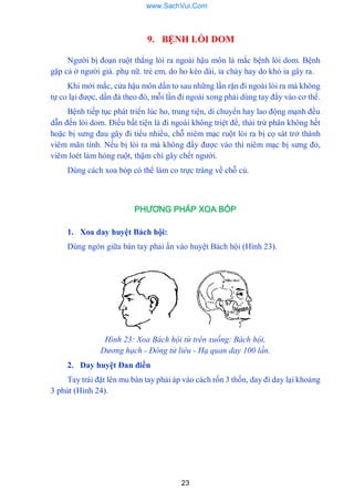 23
9. BỆNH LÒI DOM
Ngƣời bị đoạn ruột thẳng lòi ra ngoài hậu môn là mắc bệnh lòi dom. Bệnh
gặp cả ở ngƣời già. phụ nữ. trẻ em, do ho kéo dài, ỉa chảy hay do khó ỉa gây ra.
Khi mới mắc, cửa hậu môn dần to sau những lần rặn đi ngoài lòi ra mà không
tự co lại đƣợc, dần đà theo đó, mỗi lần đi ngoài xong phải dùng tay đẩy vào cơ thể.
Bệnh tiếp tục phát triển lúc ho, trung tiện, di chuyển hay lao động mạnh đều
dẫn đến lòi dom. Điều bất tiện là đi ngoài không triệt để, thái trừ phân không hết
hoặc bị sƣng đau gây đi tiểu nhiều, chỗ niêm mạc ruột lòi ra bị cọ sát trở thành
viêm mãn tính. Nếu bị lòi ra mà không đẩy đƣợc vào thì niêm mạc bị sƣng đỏ,
viêm loét làm hỏng ruột, thậm chí gây chết ngƣời.
Dùng cách xoa bóp có thể làm co trực tràng về chỗ củ.
PHƯƠNG PHÁP XOA BÓP
1. Xoa day huyệt Bách hội:
Dùng ngón giữa bàn tay phải ấn vào huyệt Bách hội (Hình 23).
Hình 23: Xoa Bách hội từ trên xuống: Bách hội,
Dương hạch - Đông tử liêu - Hạ quan day 100 lần.
2. Day huyệt Đan điền
Tay trái đặt lên mu bàn tay phải áp vào cách rốn 3 thốn, day đi day lại khoảng
3 phút (Hình 24).
www.SachVui.Com
 