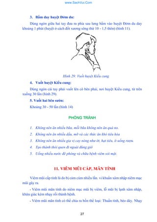 27
3. Bấm day huyệt Đởm du:
Dùng ngón giữa hai tay đƣa ra phía sau lƣng bấm vào huyệt Đởm du day
khoảng 1 phút (huyệt ở cách đốt xƣơng sông thứ 10 - 1,5 thôn) (hình 11).
Hình 29: Vuốt huyệt Kiều cung
4. Vuốt huyệt Kiểu cung:
Dùng ngón cái tay phải vuốt lên cô bên phải, nơi huyệt Kiều cung, từ trên
xuống 30 lần (hình 29).
5. Vuốt hai bên sƣờn:
Khoảng 30 - 50 lần (hình 14)
PHÒNG TRÁNH
1. Không nên ăn nhiều bữa, mỗi bữa không nên ăn quá no.
2. Không nên ăn nhiều dầu, mỡ và các thức ăn khó tiêu hóa
3. Không nên ăn nhiều gia vị cay nóng như ớt, hạt tiêu, ít uống rượu.
4. Tạo thành thói quen đi ngoài đúng giờ
5. Uống nhiều nước đê phòng và chữa bệnh viêm sỏi mật.
11. VIÊM MŨI CẤP, MÃN TÍNH
Viêm mũi cấp tính là do bị cảm cúm nhiều lần. vi khuẩn xâm nhập niêm mạc
mũi gây ra.
- Viêm mũi mãn tính do niêm mạc mũi bị viêm, lỗ mũi bị lạnh xâm nhập,
khứu giác kém nhạy rồi thành bệnh.
- Viêm mũi mãn tính có thể chia ra bốn thể loại: Thuần tính, béo dày. Nhạy
www.SachVui.Com
 