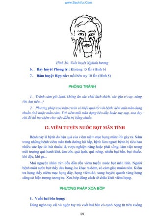 29
Hình 30: Vuốt huyệt Nghinh hương
6. Day huyêt Phong trì: Khoảng 15 lần (Hình 6)
7. Bẩm huyệt Hợp cốc: mỗi bên tay 10 lần (Hình 8)
PHÒNG TRÁNH
1. Tránh cảm gió lạnh, không ăn các chất kích thích, các gia vị cay, nóng
(ớt, hạt tiêu...)
2. Phương pháp xoa bóp ở trên có hiệu quả tốt với bệnh viêm mũi mãn dạng
thuần tính hoặc mẫn cảm. Với viêm mũi mãn dạng béo dầy hoặc suy sụp, xoa day
chỉ để hỗ trợ thêm cho việc điều trị bằng thuốc.
12. VIÊM TUYẾN NƢỚC BỌT MÃN TÍNH
Bệnh này là bệnh do hậu quả của viêm niêm mạc họng mãn tính gây ra. Nằm
trong những bệnh viêm mãn tính đƣờng hô hấp, bệnh làm ngƣời bệnh bị tiêu hao
nhiều sức lực do hút thuốc lá, rƣợu nghiện nặng hoặc phải sống, làm việc trong
môi trƣờng quá hanh khô, ẩm ƣớt, quá lạnh, quá nóng, nhiều bụi bẩn, bụi thuốc,
khí độc, khí ga...
Mọi nguyên nhân trên đều dẫn đến viêm tuyến nƣớc bọt mãn tính. Ngƣời
bệnh nuốt nƣớc bọt thấy đau họng, ho khạc ra đờm, có cảm giác muốn nôn. Kiểm
tra họng thấy niêm mạc họng đầy, họng viêm đỏ, xung huyết; quanh vùng họng
cũng có hiện tƣợng tƣơng tự. Xoa bóp đúng cách sẽ chữa khỏi viêm họng.
PHƯƠNG PHÁP XOA BÓP
1. Vuốt hai bên họng:
Dùng ngón tay cái và ngón tay trỏ vuốt hai bên có cạnh họng từ trên xuống
www.SachVui.Com
 