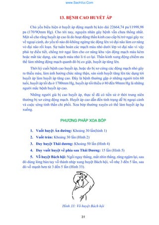 31
13. BỆNH CAO HUYẾT ÁP
Chủ yếu biểu hiện ở huyết áp động mạnh bị kéo dài 22664,74 pa/11998,98
pa (170/9Ọmm Hg). Cho tới nay, nguyên nhân gây bệnh vẫn chƣa thống nhất.
Một số cho rằng huyết áp cao là do hoạt động thần kinh cao cấp bị trở ngại gây ra:
về ngoại cảnh, do yếu tố nào đó không ngừng tác động lên vỏ đại não làm cơ năng
vỏ đại não rối loạn. Sự tuần hoàn các mạch máu nhỏ dƣới lớp vỏ đại não vì vậy
phải tự điều tiết, chống trở ngại làm cho cơ năng khu vận động mạch máu kém
hoặc mất tác dụng, các mạch máu nhỏ li ti co lại. Thần kinh xung động chiếm ƣu
thế làm những động mạch quanh đó bị co giật, huyết áp tăng lên.
Thời kỳ cuối bệnh cao huyết áp, hoặc do bị xơ cứng các động mạch nhỏ gây
ra thiếu máu, làm ảnh hƣởng chức năng thận, sản sinh huyết tăng lên tác dụng tới
huyết áp làm huyết áp tăng cao. Đây là bệnh thƣờng gặp ở những ngƣời trên 60
tuổi, huyết áp tối đa ở 1700mm Hg, huyết áp tối thiểu ở 80 đến 90mm Hg là những
ngƣời mắc bệnh huyết áp cao.
Những ngƣời già bị cao huyết áp, thực tế đã có tiền sử ở thời trung niên
thƣờng bị xơ cứng động mạch. Huyết áp cao dẫn đến tình trạng dễ bị ngoại cảnh
và cuộc sông tinh thần chi phối. Xoa bóp thƣờng xuyên có thể làm huyết áp hạ
xuống.
PHƯƠNG PHÁP XOA BÓP
1. Vuốt huyệt Ấn đƣờng: Khoảng 30 lần(hình 1)
2. Vuốt trán: Khoảng 30 lần (Hình 2)
3. Day huyệt Thái dƣơng: Khoảng 50 lần (Hình 4)
4. Day vuốt huyệt về phía sau Thái Dƣơng: 15 lần (Hình 5)
5. Vỗ huyệt Bách hội: Ngồi ngay thẳng, mắt nhìn thẳng, răng ngậm lại, sau
đó dùng lòng bàn tay vỗ thành nhịp xung huyệt Bách hội, vỗ nhẹ 3 đến 5 lần, sau
đó vỗ mạnh hơn từ 3 đến 5 lần (Hình 33).
Hình 33: Võ huyệt Bách hội
www.SachVui.Com
 