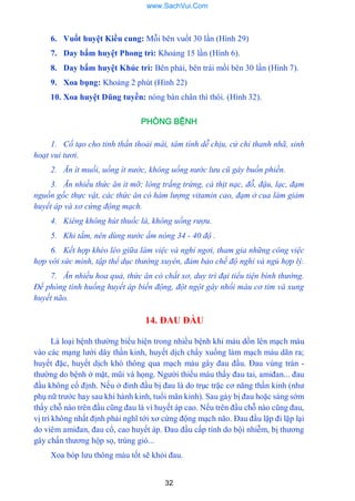 32
6. Vuốt huyệt Kiều cung: Mỗi bên vuốt 30 lần (Hình 29)
7. Day bấm huyệt Phong trì: Khoảng 15 lần (Hình 6).
8. Day bấm huyệt Khúc trì: Bên phải, bên trái mồi bên 30 lần (Hình 7).
9. Xoa bụng: Khoảng 2 phút (Hình 22)
10. Xoa huyệt Dũng tuyền: nóng bàn chân thì thôi. (Hình 32).
PHÒNG BỆNH
1. Cố tạo cho tinh thần thoải mái, tâm tính dễ chịu, cử chỉ thanh nhã, sinh
hoạt vui tươi.
2. Ăn ít muối, uống ít nước, không uống nước lưu cũ gây buồn phiền.
3. Ăn nhiều thức ăn ít mỡ; lòng trắng trứng, cá thịt nạc, đỗ, đậu, lạc, đạm
nguồn gốc thực vật, các thức ăn có hàm lượng vitamin cao, đạm ở cua làm giảm
huyết áp và xơ cứng động mạch.
4. Kiêng không hút thuốc lá, không uống rượu.
5. Khi tắm, nên dùng nước ấm nóng 34 - 40 độ .
6. Kết hợp khéo léo giữa làm việc và nghỉ ngơi, tham gia những công việc
hợp với sức mình, tập thể dục thường xuyên, đảm bảo chế độ nghỉ và ngủ hợp lý.
7. Ăn nhiều hoa quả, thức ăn có chất xơ, duy trì đại tiểu tiện bình thường.
Đề phòng tình huống huyết áp biến động, đột ngột gây nhồi máu cơ tim và xung
huyết não.
14. ĐAU ĐẦU
Là loại bệnh thƣờng biểu hiện trong nhiều bệnh khi máu dồn lên mạch máu
vào các mạng lƣới dây thần kinh, huyết dịch chẩy xuống làm mạch máu dãn ra;
huyết đặc, huyết dịch khó thông qua mạch máu gây đau đầu. Đau vùng trán -
thƣờng do bệnh ở mặt, mũi và họng. Ngƣời thiếu máu thấy đau tai, amiđan... đau
đầu không cố định. Nếu ở đỉnh đầu bị đau là do trục trặc cơ năng thần kinh (nhƣ
phụ nữ trƣớc hay sau khi hành kinh, tuổi mãn kinh). Sau gáy bị đau hoặc sáng sớm
thấy chỗ nào trên đầu cũng đau là vì huyết áp cao. Nếu trên đầu chỗ nào cũng đau,
vị trí không nhất định phải nghĩ tới xơ cứng động mạch não. Đau đầu lặp đi lặp lại
do viêm amiđan, đau cổ, cao huyết áp. Đau đầu cấp tính do bội nhiễm, bị thƣơng
gây chấn thƣơng hộp sọ, trúng gió...
Xoa bóp lƣu thông máu tốt sẽ khỏi đau.
www.SachVui.Com
 