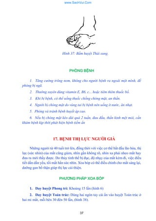 37
Hình 37: Bấm huyệt Thái xung.
PHÒNG BỆNH
1. Tăng cường trông nom, không cho người bệnh ra ngoài một mình, đề
phòng bị ngã.
2. Thường xuyên dùng vitamin E, B6, c... hoặc tiêm thêm thuốc bố.
3. Khi bị bệnh, có thể uống thuốc chống chóng mặt, an thần.
4. Người bị chóng mặt do vùng tai bị bệnh nên uống ít nước, ăn nhạt.
5. Phòng và tránh bệnh huyết áp cao.
6. Nếu bị chóng mặt kéo dài quá 2 tuần, đau đầu, thần kinh mệt mỏi, cần
khám bệnh kịp thời phát hiện bệnh tiềm ẩn
17. BỆNH THỊ LỰC NGƢỜI GIÀ
Những ngƣời từ 40 tuổi trở lên, đồng thời với việc cơ thể bắt đầu lão hóa, thị
lực (sức nhìn) của mắt cũng giảm, nhìn gần không rõ, nhìn xa phải nheo mắt hay
đƣa ra mới thấy đƣợc. Do thủy tinh thể bị đục, độ nhạy của mắt kém đi, việc điều
tiết dần dần yếu, tối mất hẳn sức nhìn. Xoa bóp có thể điều chỉnh cho mắt sáng lại,
dƣỡng gan bổ thận giúp thị lực cải thiện.
PHƯƠNG PHÁP XOA BÓP
1. Day huyệt Phong trì: Khoảng 15 lần (hình 6)
2. Day huyệt Toản trúc: Dùng hai ngón tay cái ấn vào huyệt Toản trúc ở
hai mi mắt, mỗi bên 30 đên 50 lần, (hình 38).
www.SachVui.Com
 