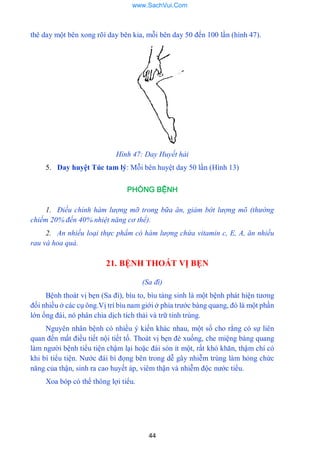 44
thê day một bên xong rõí day bên kia, mỗi bên day 50 đến 100 lần (hình 47).
Hình 47: Day Huyết hải
5. Day huyệt Túc tam lý: Mỗi bên huyệt day 50 lần (Hình 13)
PHÒNG BỆNH
1. Điều chỉnh hàm lượng mỡ trong bữa ăn, giảm bớt lượng mõ (thường
chiếm 20% đến 40% nhiệt năng cơ thể).
2. An nhiều loại thực phẩm có hàm lượng chứa vitamin c, E, A, ăn nhiều
rau và hoa quả.
21. BỆNH THOÁT VỊ BẸN
(Sa đì)
Bệnh thoát vị bẹn (Sa đì), bìu to, bìu tàng sinh là một bệnh phát hiện tƣơng
đối nhiều ở các cụ ông.Vị trí bìu nam giới ở phía trƣớc bàng quang, đó là một phần
lớn ống đái, nó phân chia dịch tích thải và trữ tinh trùng.
Nguyên nhân bệnh có nhiều ý kiến khác nhau, một số cho rằng có sự liên
quan đến mất điều tiết nội tiết tố. Thoát vị bẹn đè xuống, che miệng bàng quang
làm ngƣời bệnh tiểu tiện chậm lại hoặc đái són ít một, rất khó khăn, thậm chí có
khi bí tiểu tiện. Nƣớc đái bí đọng bên trong dễ gây nhiễm trùng làm hỏng chức
năng của thận, sinh ra cao huyết áp, viêm thận và nhiễm độc nƣớc tiểu.
Xoa bóp có thể thông lợi tiểu.
www.SachVui.Com
 