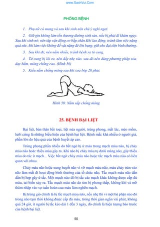 50
PHÒNG BỆNH
1. Phụ nữ có mang và sau khi sinh nên chú ý nghỉ ngơi.
2. Giữ gìn không làm tổn thương đường sinh sản, nếu bị phải đi khám ngay.
Sau khi sinh nở, nên tập vận động cơ bắp chân.Khi lao động, tránh làm việc nặng
quá sức, khi làm việc không để vật nặng đè lên bụng, giữ cho đại tiện bình thường.
3. Sau khi đẻ, nên nằm nhiều, tránh bệnh sa tử cung.
4. Tử cung bị lòi ra, nên đẩy nhẹ vào, sau đó nên dùng phương pháp xoa,
day bấm, mông chổng cao. (Hình 50)
5. Kiểu nằm chổng mông sau khi xoa bóp 20 phút.
Hình 50: Nằm sấp chổng mông
25. BỆNH BẠI LIỆT
Bại liệt, bán thân bất toại, liệt nửa ngƣời, trúng phong, mắt lác, méo mồm,
lƣỡi cứng là những biểu hiện của bệnh bại liệt. Bệnh mắc khá nhiều ở ngƣời già,
phần lớn do hậu quả của bệnh huyết áp cao.
Trúng phong phần nhiều do bất ngờ bị ứ máu trong mạch máu não, bị chảy
máu não hoăc thiếu máu gây ra. Khi não bị chảy máu tụ dƣới màng não, gây thiếu
máu do tắc ứ mạch... Việc bất ngờ chảy máu não hoặc tắc mạch máu não có liên
quan với nhau.
Chảy máu não hoặc xung huyết não vì vỡ mạch máu não, máu chảy tràn vào
não làm mất đi hoạt động bình thƣờng của tổ chức não. Tắc mạch máu não dần
dần bị hẹp gây ứ tắc. Một mạch nào đó bị tắc các mạch khác không đƣợc cấp đủ
máu, tai biến xảy ra. Tắc mạch máu não do tim bị phong thấp, không khí và mỡ
thâm nhập vào sự tuần hoàn cua máu làm nghẽn mạch.
Bị trúng gió chính là bị tắc mạch máu não, nếu nhẹ thì vì một bộ phận nào đó
trong não tạm thời không đƣợc cấp đủ máu, trong thời gian ngắn vài phút, không
quá 24 giờ, ít ngƣời bị tắc kéo dài 1 đến 3 ngày, đó chính là hiện tƣợng báo trƣớc
của bệnh bại liệt.
www.SachVui.Com
 