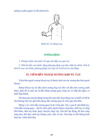 67
hƣớng ra phía ngoài 16 lần (hình 82).
Hình 82: Co khuỷu tay
PHÒNG BỆNH
1. Phòng tránh cảm lạnh, tối ngủ cần đắp cao quá vai.
2. Thời kỳ đầu của bệnh, dùng phương pháp xoa bóp chữa là chính. Nếu là
thời kỳ sau của bệnh, phương pháp xoa bóp chỉ là hỗ trợ tự vận động.
33. VIÊM BÊN NGOÀI XƢƠNG KHUỶU TAY
Viêm bên ngoài xƣơng khuỷu tay là thuộc tính của các xƣơng đau bên ngoài
khuỷu:
Khớp khuỷu tay do đầu dƣới xƣơng ống nói liền với đầu trên xƣơng cánh
dƣới, giữa lồi ra một cục là đầu khớp xƣơng quay cùng các cơ bắp dài ngắn, co
duỗi hợp thành.
Do tham gia chuyển động trong thòi gian dài, hoạt động của cơ duỗi có thể bị
tổn thƣơng làm các gân biến dạng, đầu xƣơng quay bị viêm gây đau đớn.
Đông y coi viêm đầu xƣơng quay là do viêm gân. Tây y gọi là vặn khớp tay,
viêm đầu xƣơng quay... khi bị viêm, phía ngoài khuỷu sƣng đau. duỗi tay ra cũng
khó khăn, nắm tay hoặc quay chuyển cũng vây. Sau khi lao động, đô đau càng
căng hơn, khi đau cánh tay buông xuôi, nhƣ vô lực. Xoa bóp có thể thông kinh
hoạt lạc. chữa khỏi đau.
 