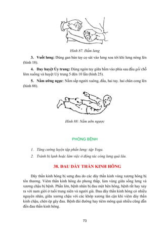 73
Hình 87. Đấm lưng
3. Vuốt lƣng: Dùng gan bàn tay cọ sát vào lƣng xoa tới khi lƣng nóng lên
(hình 18).
4. Day huyệt Ủy trung: Dùng ngón tay giữa bấm vào phía sau đầu gối chỗ
lõm xuống và huyệt Uỷ trung 5 đên 10 lần (hình 25).
5. Nằm ƣỡng ngực: Nằm sấp ngƣời xuông, đầu, hai tay. hai chân cong lên
(hình 88).
Hình 88: Nằm ưỡn ngược
PHÒNG BỆNH
1. Tăng cường luyện tập phần lưng: tập Yoga.
2. Tránh bị lạnh hoặc làm việc ở động tác còng lưng quá lâu.
38. ĐAU DẦY THẦN KINH HÔNG
Dây thần kinh hông bị sƣng đau do các dây thần kinh vùng xƣơng hông bị
tổn thƣơng. Viêm thần kinh hông do phong thấp, làm vùng giữa sống lƣng và
xƣơng chậu bị bệnh. Phần lớn, bệnh nhân bị đau một bên hông, bệnh rất hay xảy
ra với nam giới ở tuổi trung niên và ngƣời già. Đau dây thần kinh hông có nhiều
nguyên nhân, giữa xƣơng chậu với các khớp xƣơng lân cận khi viêm dây thần
kinh chậu, chèn ép gây đau. Bệnh đái đƣờng hay tiêm mông quá nhiều cũng dẫn
đến đau thần kinh hông.
 