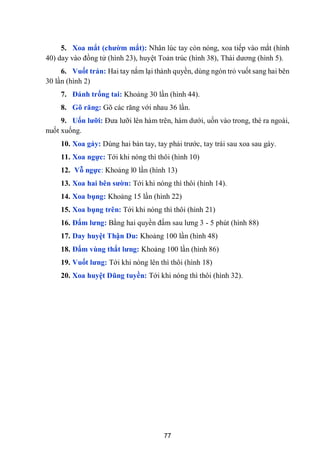 77
5. Xoa mắt (chƣờm mắt): Nhân lúc tay còn nóng, xoa tiếp vào mắt (hình
40) day vào đồng tử (hình 23), huyệt Toản trúc (hình 38), Thái dƣơng (hình 5).
6. Vuốt trán: Hai tay nắm lại thành quyền, dùng ngón trỏ vuốt sang hai bên
30 lần (hình 2)
7. Đánh trống tai: Khoảng 30 lần (hình 44).
8. Gõ răng: Gõ các răng với nhau 36 lần.
9. Uốn lƣỡi: Đƣa lƣỡi lên hàm trên, hàm dƣới, uốn vào trong, thè ra ngoài,
nuốt xuống.
10. Xoa gáy: Dùng hai bàn tay, tay phải trƣớc, tay trái sau xoa sau gáy.
11. Xoa ngực: Tới khi nóng thì thôi (hình 10)
12. Vỗ ngực: Khoảng l0 lần (hình 13)
13. Xoa hai bên sƣờn: Tới khi nóng thì thôi (hình 14).
14. Xoa bụng: Khoảng 15 lần (hình 22)
15. Xoa bụng trên: Tới khi nóng thì thôi (hình 21)
16. Đấm lƣng: Bằng hai quyền đấm sau lƣng 3 - 5 phút (hình 88)
17. Day huyệt Thận Du: Khoảng 100 lần (hình 48)
18. Đấm vùng thắt lƣng: Khoảng 100 lần (hình 86)
19. Vuốt lƣng: Tới khi nóng lên thì thôi (hình 18)
20. Xoa huyệt Dũng tuyền: Tới khi nóng thì thôi (hình 32).
 