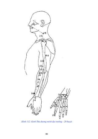 86
Hình 112: Kinh Thủ dương minh đại trường - 20 huyệt
 