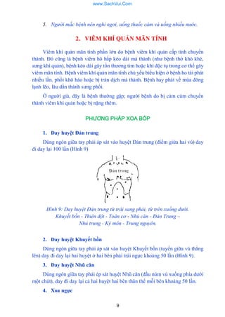 9
5. Người mắc bệnh nên nghỉ ngơi, uống thuốc cảm và uống nhiều nước.
2. VIÊM KHÍ QUẢN MÃN TÍNH
Viêm khí quản mãn tính phần lớn do bệnh viêm khí quản cấp tính chuyển
thành. Đó cũng là bệnh viêm hô hấp kéo dài mà thành (nhƣ bệnh thở khò khè,
sƣng khí quản), bệnh kéo dài gây tổn thƣơng tim hoặc khí độc tụ trong cơ thể gây
viêm mãn tính. Bệnh viêm khí quản mãn tính chủ yếu biểu hiện ở bệnh ho tái phát
nhiều lần. phổi khô háo hoặc bị tràn dịch mà thành. Bệnh hay phát về mùa đông
lạnh lẽo, lâu dần thành sƣng phổi.
Ở ngƣời già, đây là bệnh thƣờng gặp; ngƣời bệnh do bị cảm cúm chuyển
thành viêm khí quản hoặc bị nặng thêm.
PHƯƠNG PHÁP XOA BÓP
1. Day huyệt Đản trung
Dùng ngón giữa tay phải áp sát vào huyệt Đản trung (điểm giừa hai vú) day
đi day lại 100 lần (Hình 9)
Hình 9: Day huyệt Đản trung từ trái sang phải, từ trên xuống dưới.
Khuyết bồn - Thiên đột - Toàn cơ - Nhủ căn - Đản Trung –
Nhủ trung - Kỳ môn - Trung nguyên.
2. Day huyệt Khuyết bồn
Dùng ngón giữa tay phải áp sát vào huyệt Khuyết bồn (tuyến giữa vú thẳng
lên) day đi day lại hai huyệt ở hai bên phải trái ngực khoảng 50 lần (Hình 9).
3. Day huyệt Nhũ căn
Dùng ngón giữa tay phải ép sát huyệt Nhũ căn (đầu núm vú xuống phía dƣới
một chút), day đi day lại cả hai huyệt hai bên thân thể mỗi bên khoảng 50 lần.
4. Xoa ngực
www.SachVui.Com
 