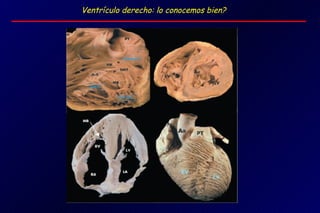 Ventrículo derecho: lo conocemos bien?
 