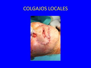 COLGAJOS LOCALES
 