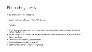 Etiopathogenesis
• It is a remnant oF the notochord.
• Usually males are affected in the 5th-7th decade.
• Pathology
• Gross: Tumour is large,round,smooth soft bluish white with fibrous septate.Bone destroyed
replaced by Tumour.
• Microscopy:Lobular Architecture is the hallmark with abundant cytoplasm and nuclear atypia
• 3 types are there
• Conventional Chordoma (Most common)
• Chondroid Chordoma(Best prognosis)
• Dedifferentiated chordoma(Poor prognosis)
 