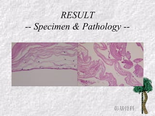 RESULT
-- Specimen & Pathology --
彰基骨科
 