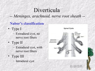 Diverticula
-- Meninges, arachnoid, nerve root sheath --
Nabor’s classification
• Type I
– Extradural cyst, no
nerve root fibers
• Type II
– Extradural cyst, with
nerve root fibers
• Type III
– Intradural cyst
彰基骨科
 
