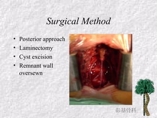 Surgical Method
• Posterior approach
• Laminectomy
• Cyst excision
• Remnant wall
oversewn
彰基骨科
 