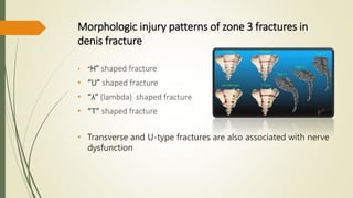 Morphologic injury patterns of zone 3 fractures in
denis fracture
• “H” shaped fracture
• “U” shaped fracture
• “ʎ” (lambda) shaped fracture
• “T” shaped fracture
• Transverse and U-type fractures are also associated with nerve
dysfunction
 