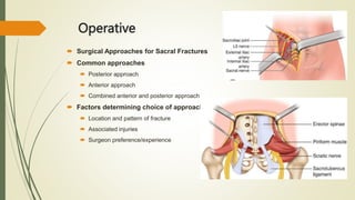  Surgical Approaches for Sacral Fractures
 Common approaches
 Posterior approach
 Anterior approach
 Combined anterior and posterior approach
 Factors determining choice of approach
 Location and pattern of fracture
 Associated injuries
 Surgeon preference/experience
Operative
 