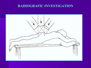 RADIOGRAFIC INVESTIGATION
 