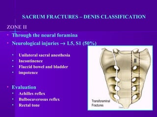 ZONE II
• Through the neural foramina
• Neurological injuries → L5, S1 (50%)
• Unilateral sacral anesthesia
• Incontinence
• Flaccid bowel and bladder
• impotence
• Evaluation
• Achilles reflex
• Bulbocaverosus reflex
• Rectal tone
SACRUM FRACTURES – DENIS CLASSIFICATION
 