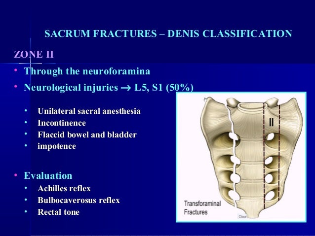 Sacral injuries