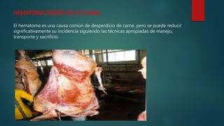 HEMATOMA SEVERO EN LA CANAL
El hematoma es una causa común de desperdicio de carne, pero se puede reducir
significativamente su incidencia siguiendo las técnicas apropiadas de manejo,
transporte y sacrificio.
 