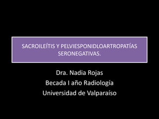 SACROILEÍTIS Y PELVIESPONIDLOARTROPATÍAS
SERONEGATIVAS.
Dra. Nadia Rojas
Becada I año Radiología
Universidad de Valparaíso
 
