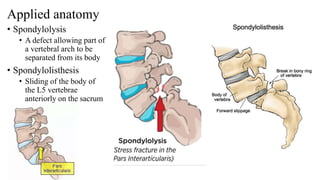 Applied anatomy
• Spondylolysis
• A defect allowing part of
a vertebral arch to be
separated from its body
• Spondylolisthesis
• Sliding of the body of
the L5 vertebrae
anteriorly on the sacrum
 