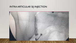 Sacroiliac joint Dr.Bnar Shawki_for SlideShare.pptx