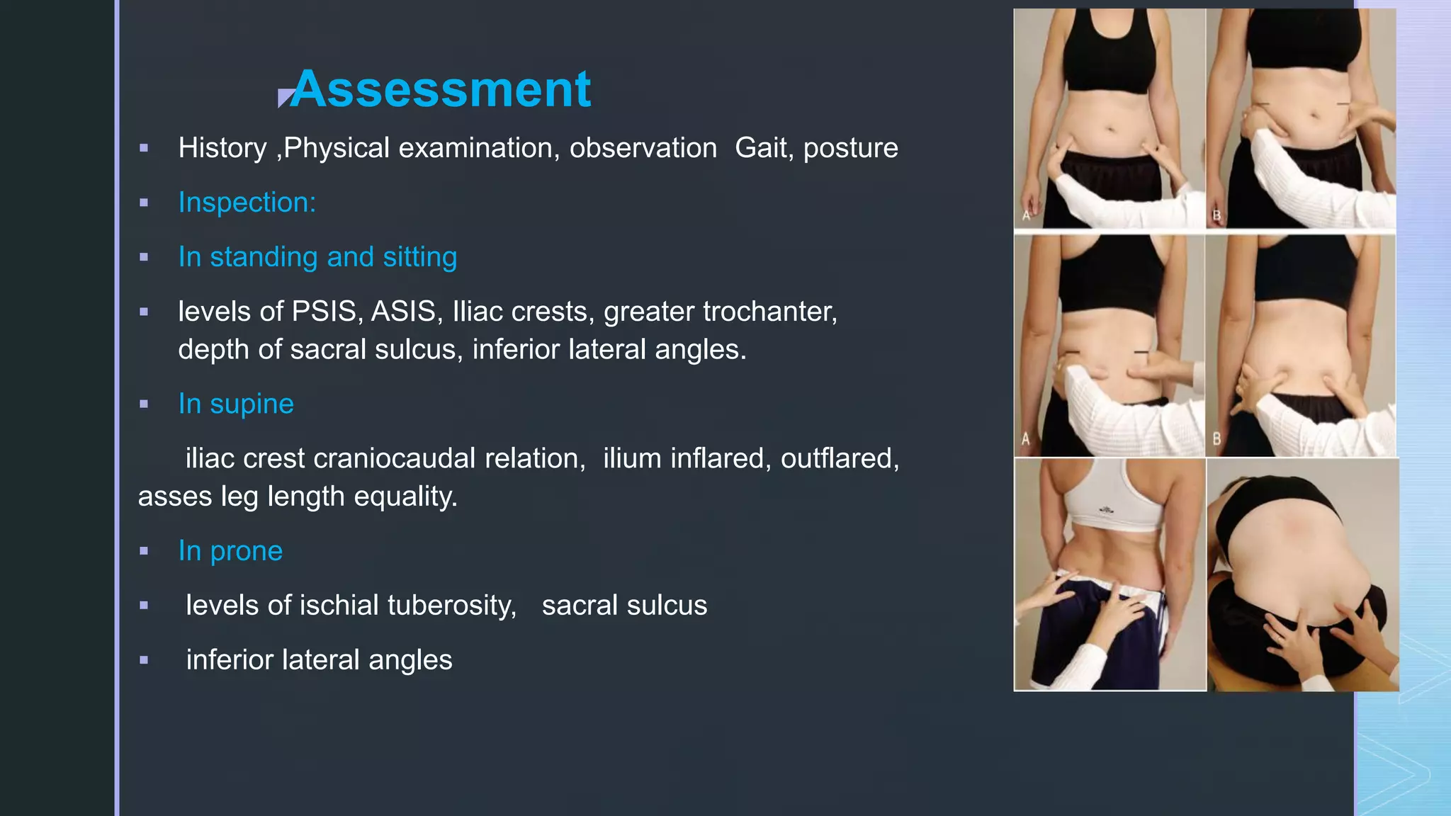 Sacroiliac joint dysfunction | PPTX