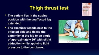 Thigh thrust test
• The patient lies in the supine
position with the unaffected leg
extended.
• The examiner stands next to the
affected side and flexes the
extremity at the hip to an angle
of approximately 90° with slight
adduction while applying light
pressure to the bent knee.
 