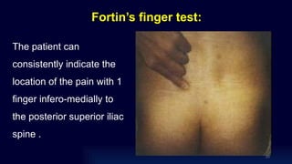 Fortin’s finger test:
The patient can
consistently indicate the
location of the pain with 1
finger infero-medially to
the posterior superior iliac
spine .
20
 