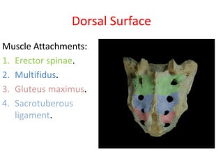 Dorsal Surface
Muscle Attachments:
1. Erector spinae.
2. Multifidus.
3. Gluteus maximus.
4. Sacrotuberous
ligament.
 