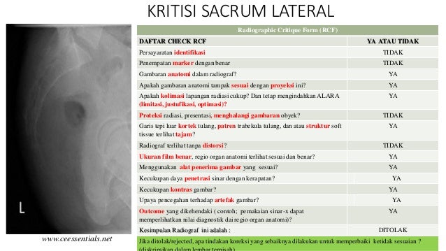 Contoh Identifikasi Film - Contoh Soal2