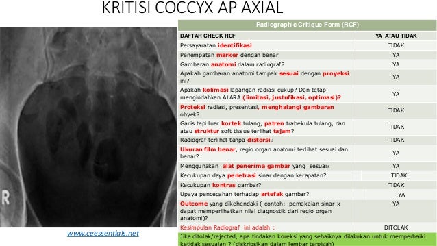 Ppt kritisi dan evaluasi radiograf Sacrum dan coccyx