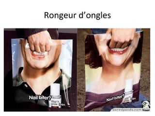 Rongeur d’ongles
 