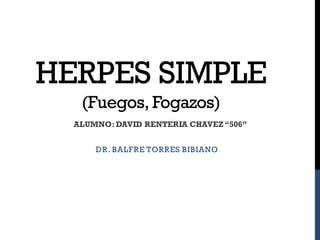 HERPES SIMPLE
(Fuegos, Fogazos)
DR. BALFRE TORRES BIBIANO
ALUMNO:DAVID RENTERIA CHAVEZ“506”
 