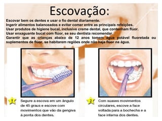 Escovação:
Escovar bem os dentes e usar o fio dental diariamente.
Ingerir alimentos balanceados e evitar comer entre as principais refeições.
Usar produtos de higiene bucal, inclusive creme dental, que contenham flúor.
Usar enxaguante bucal com flúor, se seu dentista recomendar.
Garantir que as crianças abaixo de 12 anos tomem água potável fluoretada ou
suplementos de flúor, se habitarem regiões onde não haja flúor na água.
 