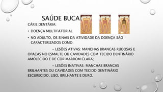 SAÚDE BUCAL DO ADULTO
CÁRIE DENTÁRIA:
• DOENÇA MULTIFATORIAL
• NO ADULTO, OS SINAIS DA ATIVIDADE DA DOENÇA SÃO
CARACTERIZADOS COMO:
- LESÕES ATIVAS: MANCHAS BRANCAS RUGOSAS E
OPACAS NO ESMALTE OU CAVIDADES COM TECIDO DENTINÁRIO
AMOLECIDO E DE COR MARROM CLARA;
- LESÕES INATIVAS: MANCHAS BRANCAS
BRILHANTES OU CAVIDADES COM TECIDO DENTINÁRIO
ESCURECIDO, LISO, BRILHANTE E DURO.
 