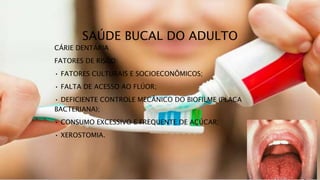 SAÚDE BUCAL DO ADULTO
CÁRIE DENTÁRIA
FATORES DE RISCO:
• FATORES CULTURAIS E SOCIOECONÔMICOS;
• FALTA DE ACESSO AO FLÚOR;
• DEFICIENTE CONTROLE MECÂNICO DO BIOFILME (PLACA
BACTERIANA);
• CONSUMO EXCESSIVO E FREQUENTE DE AÇÚCAR;
• XEROSTOMIA.
 