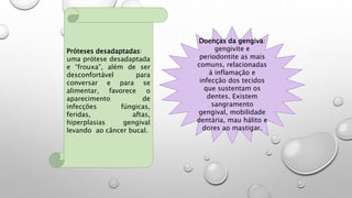 Doenças da gengiva:
gengivite e
periodontite as mais
comuns, relacionadas
à inflamação e
infecção dos tecidos
que sustentam os
dentes. Existem
sangramento
gengival, mobilidade
dentária, mau hálito e
dores ao mastigar.
Próteses desadaptadas:
uma prótese desadaptada
e “frouxa”, além de ser
desconfortável para
conversar e para se
alimentar, favorece o
aparecimento de
infecções fúngicas,
feridas, aftas,
hiperplasias gengival
levando ao câncer bucal.
 