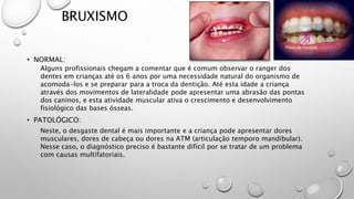 BRUXISMO
• NORMAL:
• PATOLÓGICO:
Alguns profissionais chegam a comentar que é comum observar o ranger dos
dentes em crianças até os 6 anos por uma necessidade natural do organismo de
acomoda-los e se preparar para a troca da dentição. Até esta idade a criança
através dos movimentos de lateralidade pode apresentar uma abrasão das pontas
dos caninos, e esta atividade muscular ativa o crescimento e desenvolvimento
fisiológico das bases ósseas.
Neste, o desgaste dental é mais importante e a criança pode apresentar dores
musculares, dores de cabeça ou dores na ATM (articulação temporo mandibular).
Nesse caso, o diagnóstico preciso é bastante difícil por se tratar de um problema
com causas multifatoriais.
 