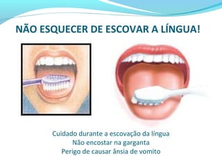 Cuidado durante a escovação da língua
Não encostar na garganta
Perigo de causar ânsia de vomito
NÃO ESQUECER DE ESCOVAR A LÍNGUA!
 