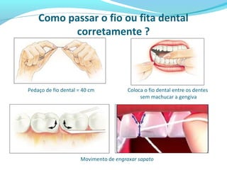 Como passar o fio ou fita dental
corretamente ?
Pedaço de fio dental = 40 cm
Movimento de engraxar sapato
Coloca o fio dental entre os dentes
sem machucar a gengiva
 