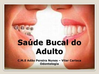 Saúde Bucal do
    Adulto
C.M.S Adão Pereira Nunes – Vilar Carioca
             Odontologia
 
