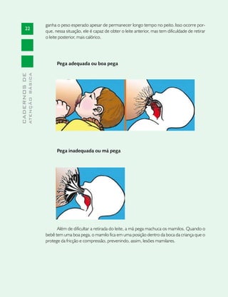 ganha o peso esperado apesar de permanecer longo tempo no peito. Isso ocorre por-
       22
                               que, nessa situação, ele é capaz de obter o leite anterior, mas tem dificuldade de retirar
                               o leite posterior, mais calórico.




                                     Pega adequada ou boa pega
              ATENÇÃO BÁSICA
CADERNOS DE




                                     Pega inadequada ou má pega




                                     Além de dificultar a retirada do leite, a má pega machuca os mamilos. Quando o
                               bebê tem uma boa pega, o mamilo fica em uma posição dentro da boca da criança que o
                               protege da fricção e compressão, prevenindo, assim, lesões mamilares.
 