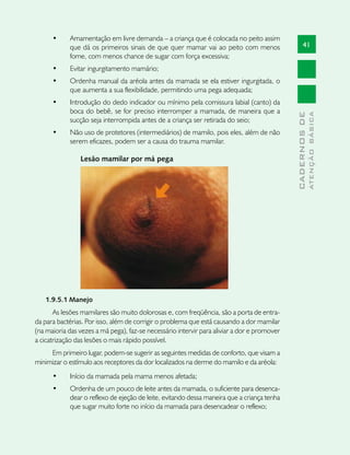 •	    Amamentação em livre demanda – a criança que é colocada no peito assim
            que dá os primeiros sinais de que quer mamar vai ao peito com menos                    41
            fome, com menos chance de sugar com força excessiva;
      •	    Evitar ingurgitamento mamário;
      •	    Ordenha manual da aréola antes da mamada se ela estiver ingurgitada, o
            que aumenta a sua flexibilidade, permitindo uma pega adequada;
      •	    Introdução do dedo indicador ou mínimo pela comissura labial (canto) da
            boca do bebê, se for preciso interromper a mamada, de maneira que a




                                                                                                           ATENÇÃO BÁSICA
                                                                                             CADERNOS DE
            sucção seja interrompida antes de a criança ser retirada do seio;
      •	    Não uso de protetores (intermediários) de mamilo, pois eles, além de não
            serem eficazes, podem ser a causa do trauma mamilar.

                Lesão mamilar por má pega




   1.9.5.1 Manejo
       As lesões mamilares são muito dolorosas e, com freqüência, são a porta de entra-
da para bactérias. Por isso, além de corrigir o problema que está causando a dor mamilar
(na maioria das vezes a má pega), faz-se necessário intervir para aliviar a dor e promover
a cicatrização das lesões o mais rápido possível.
     Em primeiro lugar, podem-se sugerir as seguintes medidas de conforto, que visam a
minimizar o estímulo aos receptores da dor localizados na derme do mamilo e da aréola:
      •	    Início da mamada pela mama menos afetada;
      •	    Ordenha de um pouco de leite antes da mamada, o suficiente para desenca-
            dear o reflexo de ejeção de leite, evitando dessa maneira que a criança tenha
            que sugar muito forte no início da mamada para desencadear o reflexo;
 