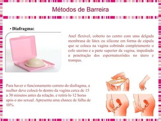 Métodos de Barreira
• Diafragma:
Anel flexível, coberto no centro com uma delgada
membrana de látex ou silicone em forma de cúpula
que se coloca na vagina cobrindo completamente o
colo uterino e a parte superior da vagina, impedindo
a penetração dos espermatozóides no útero e
trompas.
Para haver o funcionamento correto do diafragma, a
mulher deve colocá-lo dentro da vagina cerca de 15
a 30 minutos antes da relação, e retirá-lo 12 horas
após o ato sexual. Apresenta uma chance de falha de
10%.
 