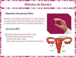 Métodos de Barreira
• Dispositivo intrauterino (DIU):
Os DIU são artefatos de polietileno aos quais podem
ser adicionados cobre ou hormônio que, inseridos na
cavidade uterina, exercem sua função contraceptiva.
•Inserção do DIU:
Momentos apropriados para iniciar o uso:
- Mulher menstruando regularmente
- Até 48 horas após o parto
- Após aborto espontâneo se não houver infecção.
 